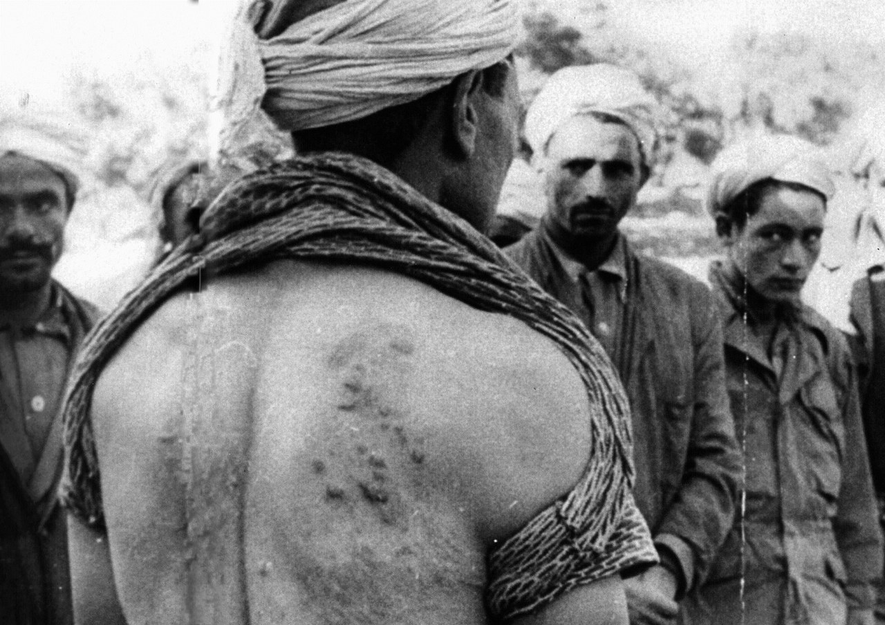 , Fotogramma della sequenza ‘Algeria: serie di fotografie di torturati e di seviziati’ nel film La rabbia di Pier Paolo Pasolini, 1963 , Fotogramma della sequenza ‘Algeria: serie di fotografie di torturati e di seviziati’ nel film La rabbia di Pier Paolo Pasolini, 1963