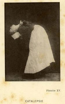 P. Régnard, Catalepsie, in J.-M. Charcot, Iconographie photographique de la Salpêtrière, 1877 P. Régnard, Catalepsie, in J.-M. Charcot, Iconographie photographique de la Salpêtrière, 1877