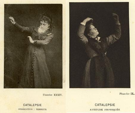 P. Régnard, Catalepsie. Suggestion terreur; Attitude provoquée, in J.-M. Charcot, Iconographie photographique de la Salpêtrière, 1877 P. Régnard, Catalepsie. Suggestion terreur; Attitude provoquée, in J.-M. Charcot, Iconographie photographique de la Salpêtrière, 1877